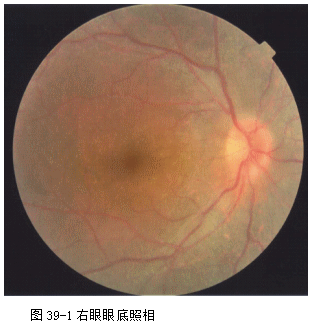 ZY016_211_2.gif